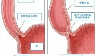 饭坑酒囊的意思是什么,出处是哪里 酒囊饭袋是什么生肖